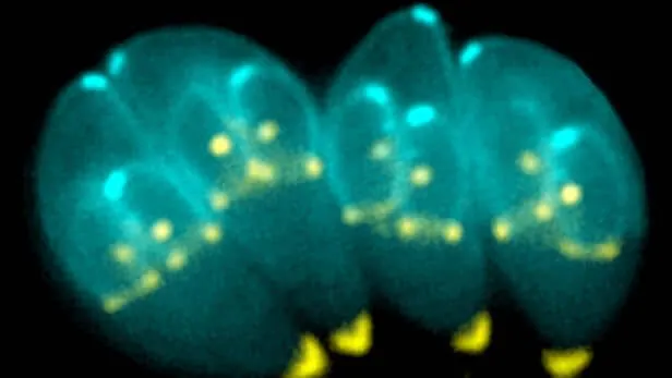 virus entrepreneur toxoplasma gondii